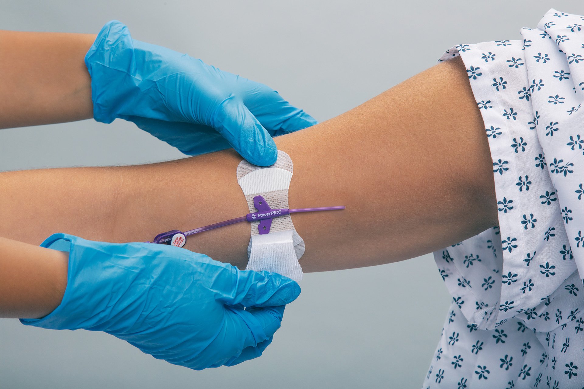 GripLok Securement Devices Optimized for Patient Comfort and Safety