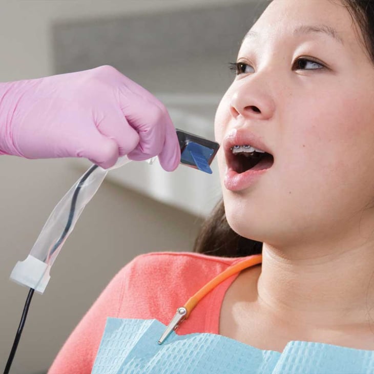 dental_bite_wing_x-ray_covers
