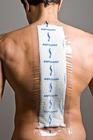 AquaGuard 7x22 Shower Cover over a large dressing on a person's spine and back area. 